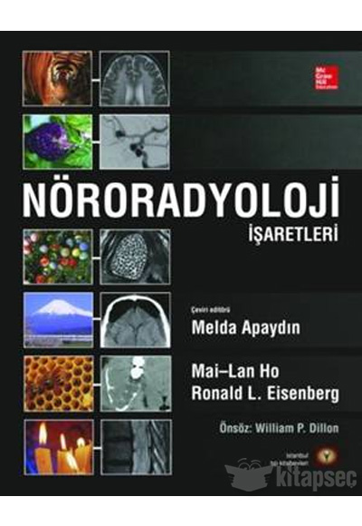 Nöroradyoloji İşaretleri Ciltli İstanbul Tıp Kitabevi