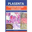 Plasenta Patolojik inceleme için El Kitabı Esin Kotiloğlu Karaa Palme Yayıncılık