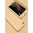 AYS Xiaomi  MI 5 Gold Sert Kapak Zore