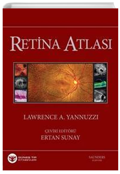 Yannuzzi Retina Atlas 2013 - Ertan Sunay Gne Tp Kitabevi
