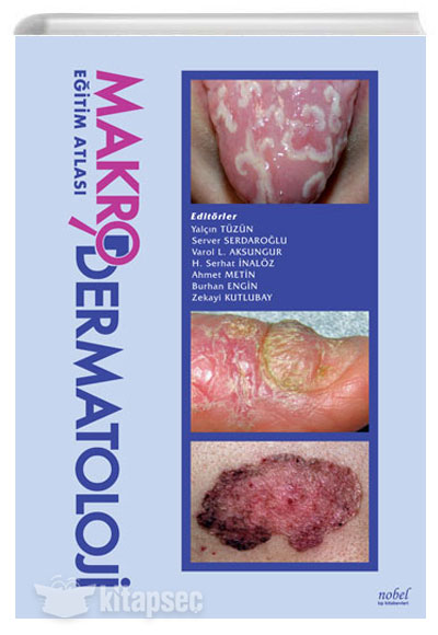 Makro Dermatoloji Eğitim Atlası Nobel Tıp Kitabevleri