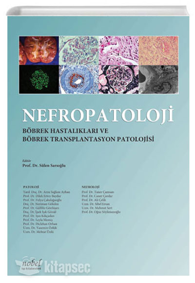 Nefropatoloji Böbrek Hastalıkları ve Böbrek Transplantasyon Patolojisi Nobel Tıp Kitabevleri