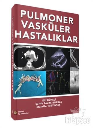 Pulmoner Vasküler Hastalıklar İstanbul Tıp Kitabevi