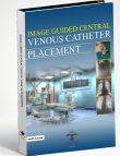 Image Guided Cenrtal Venous Catheter Placement
